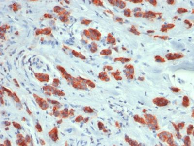 Mucin 1 / EMA / Episialin / CD227 Recombinant Monoclonal Rabbit Antibody (MUC1/1887R)