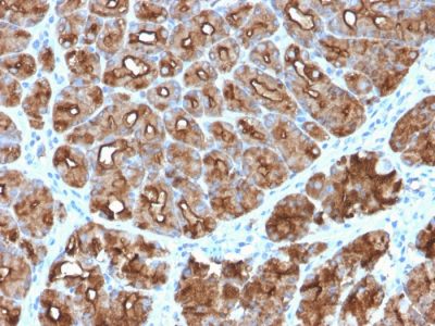 Mucin 1 / EMA / Episialin / CD227 Recombinant Monoclonal Rabbit Antibody (MUC1/2818R)