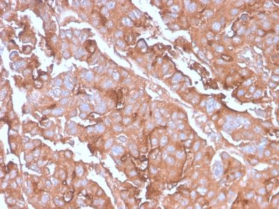 Mucin 1 / EMA / Episialin / CD227 Recombinant Monoclonal Rabbit Antibody (MUC1/2980R)