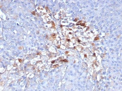 Mucin 18 / MUC18 / CD146 / MCAM Monoclonal Mouse Antibody (C146/634)