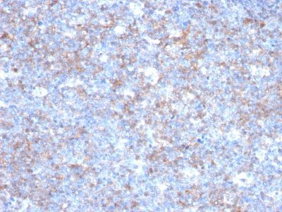 Mucin 18 / MUC18 / CD146 / MCAM Monoclonal Mouse Antibody (C146/634)
