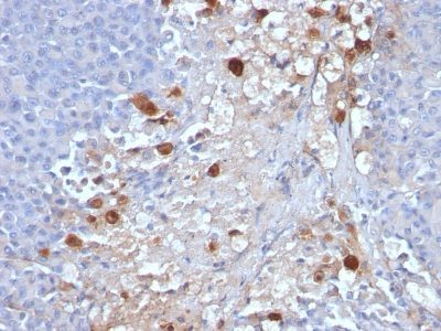 Mucin 18 / MUC18 / CD146 / MCAM Monoclonal Mouse Antibody (MCAM/1101)
