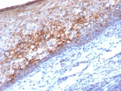 Mucin 18 / MUC18 / CD146 / MCAM Monoclonal Mouse Antibody (MCAM/1101)