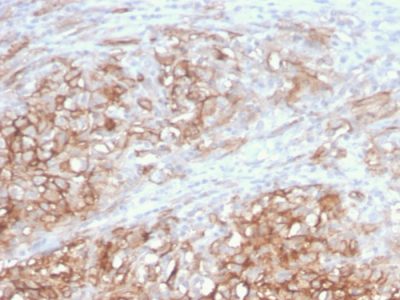 Mucin 18 / MUC18 / CD146 / MCAM Monoclonal Mouse Antibody (MCAM/3046)