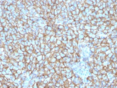 Mucin 18 / MUC18 / CD146 / MCAM Monoclonal Mouse Antibody (MCAM/3048)