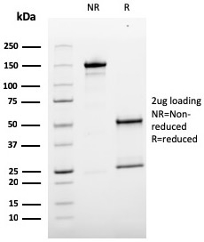Mucin 18 / MUC18 / CD146 / MCAM Monoclonal Mouse Antibody (MCAM/3179)