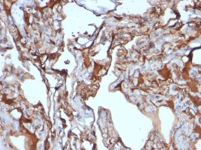 Mucin 18 / MUC18 / CD146 / MCAM Monoclonal Mouse Antibody (MUC18/1130)