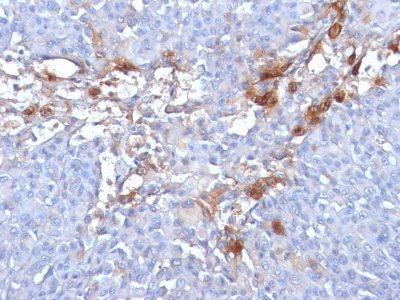 Mucin 18 / MUC18 / CD146 / MCAM Monoclonal Mouse Antibody (MUC18/1130)