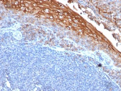 Mucin 18 / MUC18 / CD146 / MCAM Monoclonal Mouse Antibody (MUC18/1130)