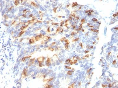 Mucin 2 / MUC2 Monoclonal Mouse Antibody (MLP/842)