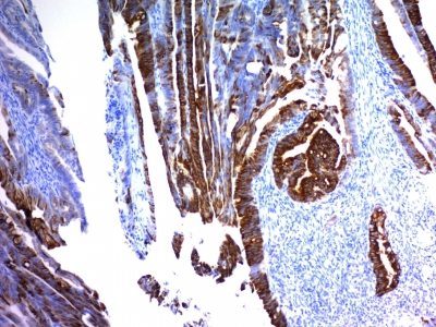 Mucin 2 / MUC2 Monoclonal Mouse Antibody (MLP/842)