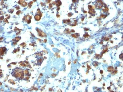 Mucin 3 / MUC 3 Monoclonal Mouse Antibody (M3.1)