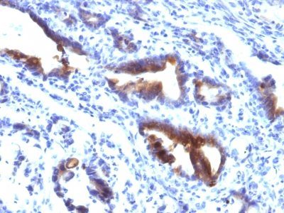 Mucin 3 / MUC 3 Monoclonal Mouse Antibody (M3.1)