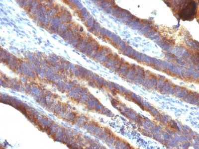 Mucin 3 / MUC 3 Monoclonal Mouse Antibody (M3.1)