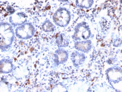 Mucin 3 / MUC 3 Recombinant Monoclonal Rabbit Antibody (MUC3/2992R)