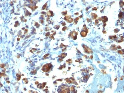 Mucin 3 Monoclonal Mouse Antibody (MUC3/1154)