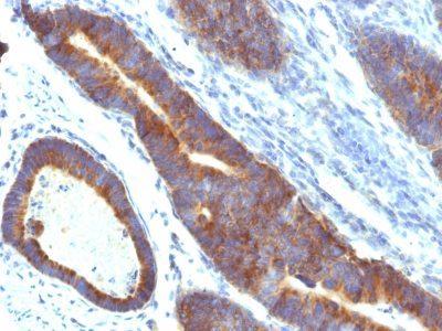 Mucin 3 Monoclonal Mouse Antibody (MUC3/1154)