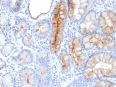 Mucin 4 / MUC4 Monoclonal Mouse Antibody (MUC4/3084)