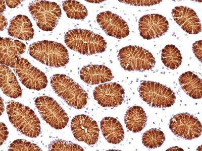 Mucin 5AC / MUC 5AC Monoclonal Mouse Antibody (45M1)
