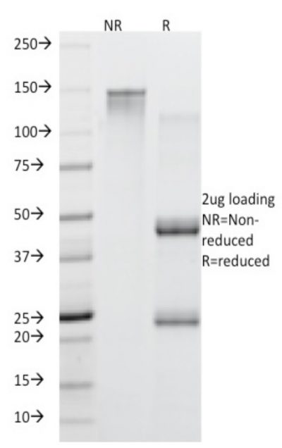 Mucin 5AC / MUC 5AC Monoclonal Mouse Antibody (45M1)