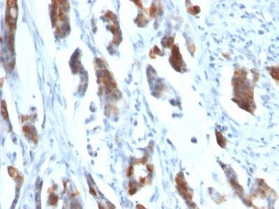 Mucin 5AC / MUC 5AC Monoclonal Mouse Antibody (58M1)
