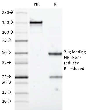 Mucin 5AC / MUC 5AC Monoclonal Mouse Antibody (58M1)