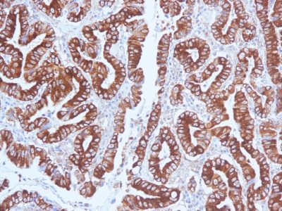 Mucin 5AC / MUC 5AC Monoclonal Mouse Antibody (CLH2)