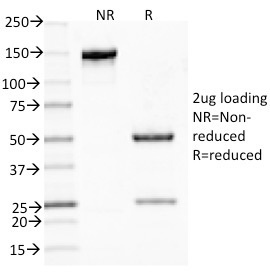 Mucin 5AC / MUC 5AC Monoclonal Mouse Antibody (CLH2)