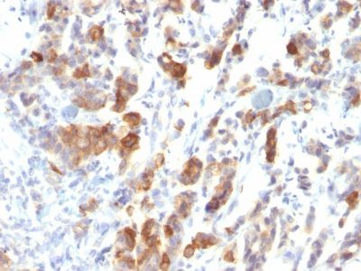 Mucin 5AC / MUC 5AC Monoclonal Mouse Antibody (MUC5AC/917)