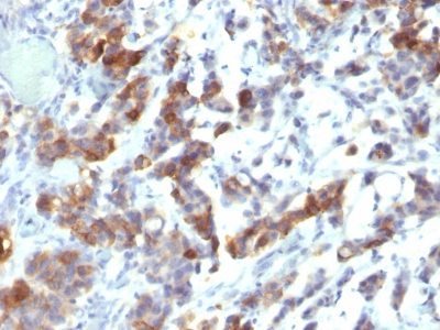 Mucin 5AC / MUC5AC Monoclonal Mouse Antibody (MUC5AC/917 + 45M1)