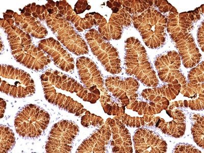 Mucin 5AC / MUC5AC Monoclonal Mouse Antibody (MUC5AC/917 + 45M1)