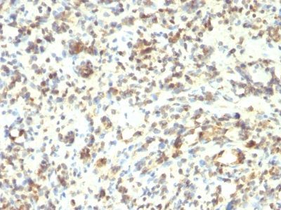 MyoD1 Monoclonal Mouse Antibody (5.8A + MYD712)