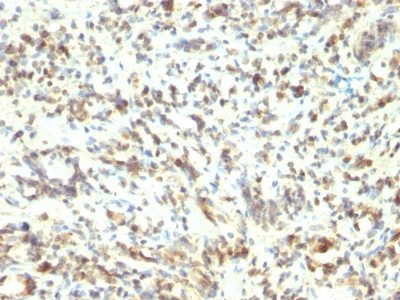 MyoD1 Monoclonal Mouse Antibody (5.8A)