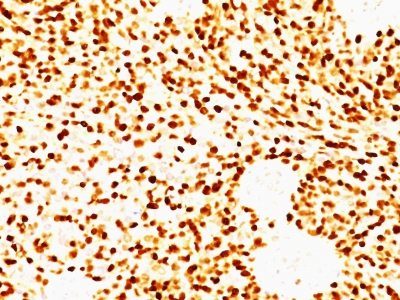 MyoD1 Monoclonal Mouse Antibody (MYD712)