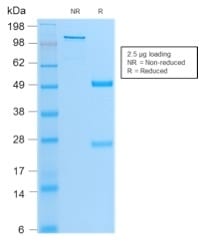 MyoD1 Recombinant Monoclonal Rabbit Antibody (MYOD1/2075R)