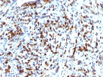 MyoD1 Recombinant Monoclonal Rabbit Antibody (MYOD1/2075R)