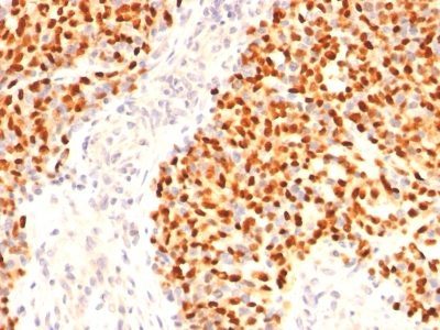 Myogenin Monoclonal Mouse Antibody (F5D)