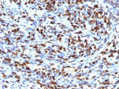 Myogenin Monoclonal Mouse Antibody (MGN185)