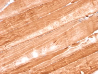 Myoglobin Monoclonal Mouse Antibody (MB/2105)