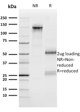 n-Myc Monoclonal Mouse Antibody (NMYC-1)
