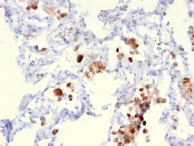 Napsin A Monoclonal Mouse Antibody (NAPSA/3306)