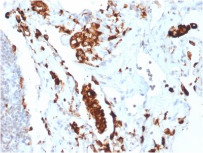 Napsin A Recombinant Monoclonal Rabbit Antibody (NAPSA/1865R)