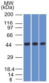 Napsin-A Monoclonal Mouse Antibody (NAPSA/1238)