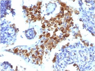 Napsin-A Monoclonal Mouse Antibody (NAPSA/1238)