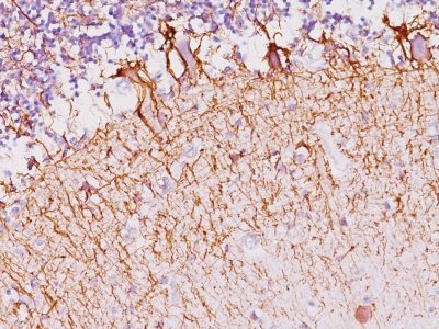 Neurofilament Monoclonal Mouse Antibody (NF421)