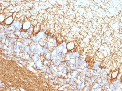 Neurofilament Monoclonal Mouse Antibody (NF421)