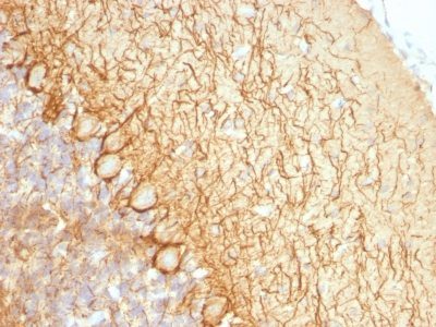 Neurofilament Monoclonal Mouse Antibody (NR-4)