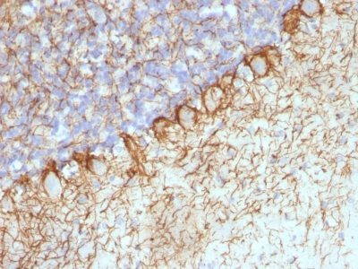 Neurofilament Monoclonal Mouse Antibody (RT-97 + NR-4)
