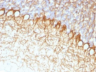 Neurofilament Monoclonal Mouse Antibody (RT-97)
