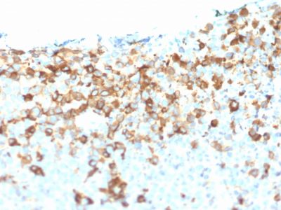 NGF Receptor Monoclonal Mouse Antibody (NGFR/1964)